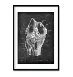 Knee Anatomy Set Of 3 - Chalkboard -Codex Anatomicus Shop 1 e4cb878c 0337 4a44 8c15 1b7b6008df0d