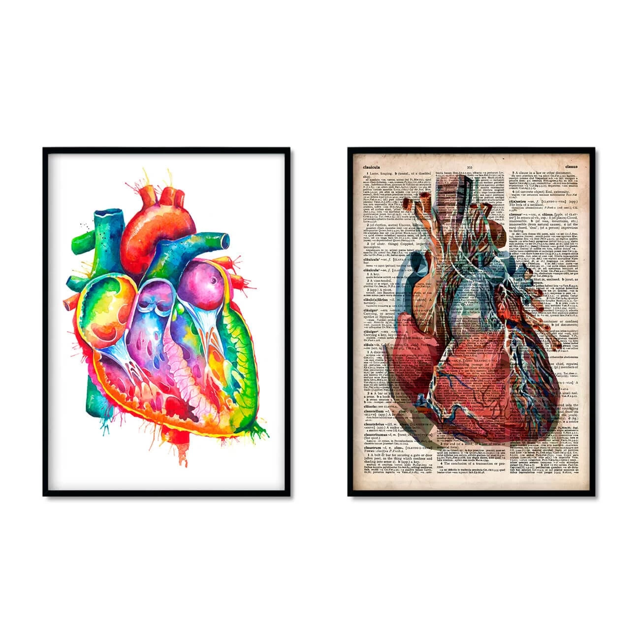 Heart Anatomy Mix - Set Of 5 5 Heart Anatomy Mix - Set Of 5 - Image 3