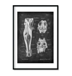 Knee Anatomy Set Of 3 - Chalkboard -Codex Anatomicus Shop 3 d4de4aa7 b13c 46cf b103 ce84519f254a