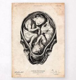 Fetus In A Womb Anatomy Print II