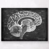 Sagittal Brain Anatomy - Chalkboard