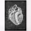 Dissected Heart Anatomy - Chalkboard 2 Dissected Heart Anatomy - Chalkboard -Codex Anatomicus Shop LPA 214