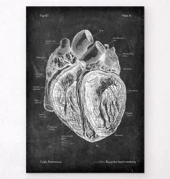 Dissected Heart Anatomy - Chalkboard