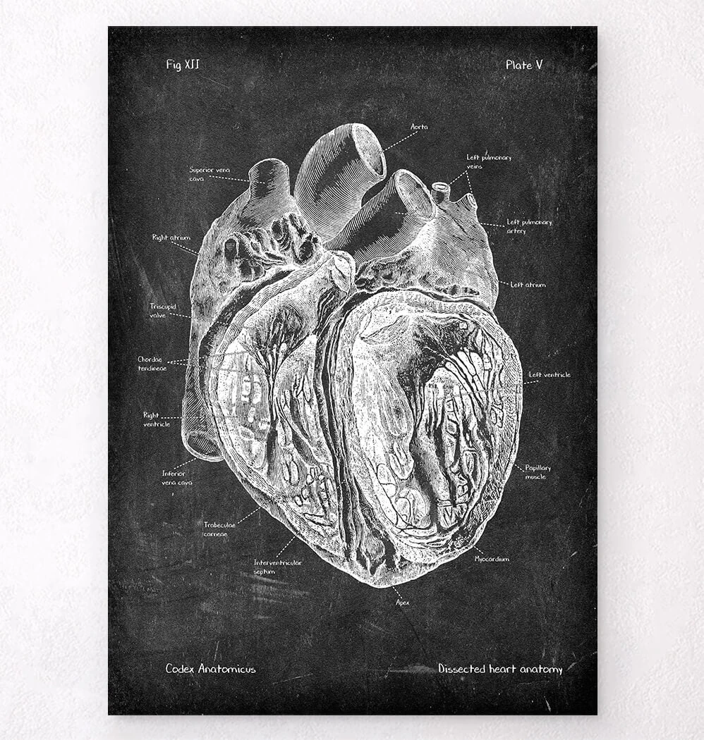Dissected Heart Anatomy - Chalkboard 3 Dissected Heart Anatomy - Chalkboard