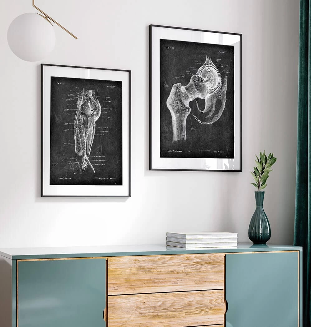 Hip Joint Anatomy - Chalkboard 5 Hip Joint Anatomy - Chalkboard - Image 3