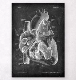 Dissected Heart Anatomy II - Chalkboard