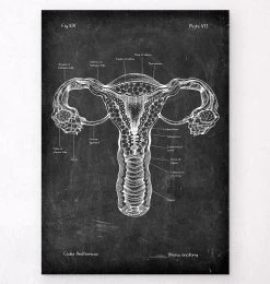 Uterus Anatomy - Chalkboard