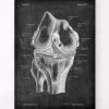Knee Anatomy - Chalkboard 2 Knee Anatomy - Chalkboard -Codex Anatomicus Shop LPA 231
