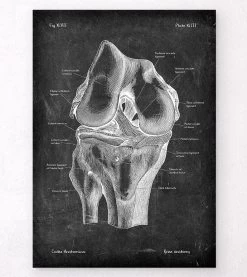 Knee Anatomy - Chalkboard