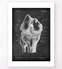Knee Anatomy - Chalkboard -Codex Anatomicus Shop LPA 231 4