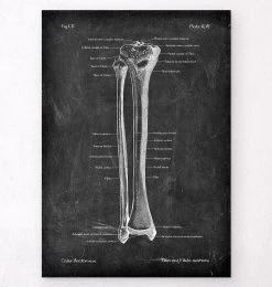 Tibia & Fibula - Chalkboard