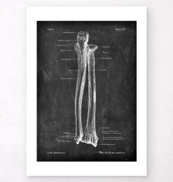 Ulna & Radius - Chalkboard -Codex Anatomicus Shop LPA 240 2