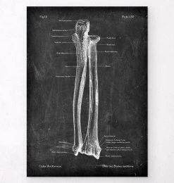 Ulna & Radius - Chalkboard