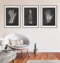 Blood Vessels Of Hand - Chalkboard -Codex Anatomicus Shop LPA 241 4