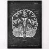 Brain Cross Section - Chalkboard -Codex Anatomicus Shop LPA 247