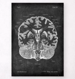 Brain Cross Section - Chalkboard