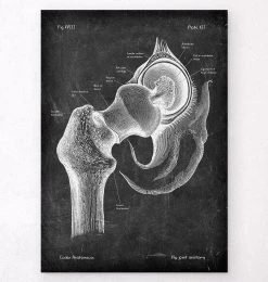 Hip Joint Anatomy - Chalkboard