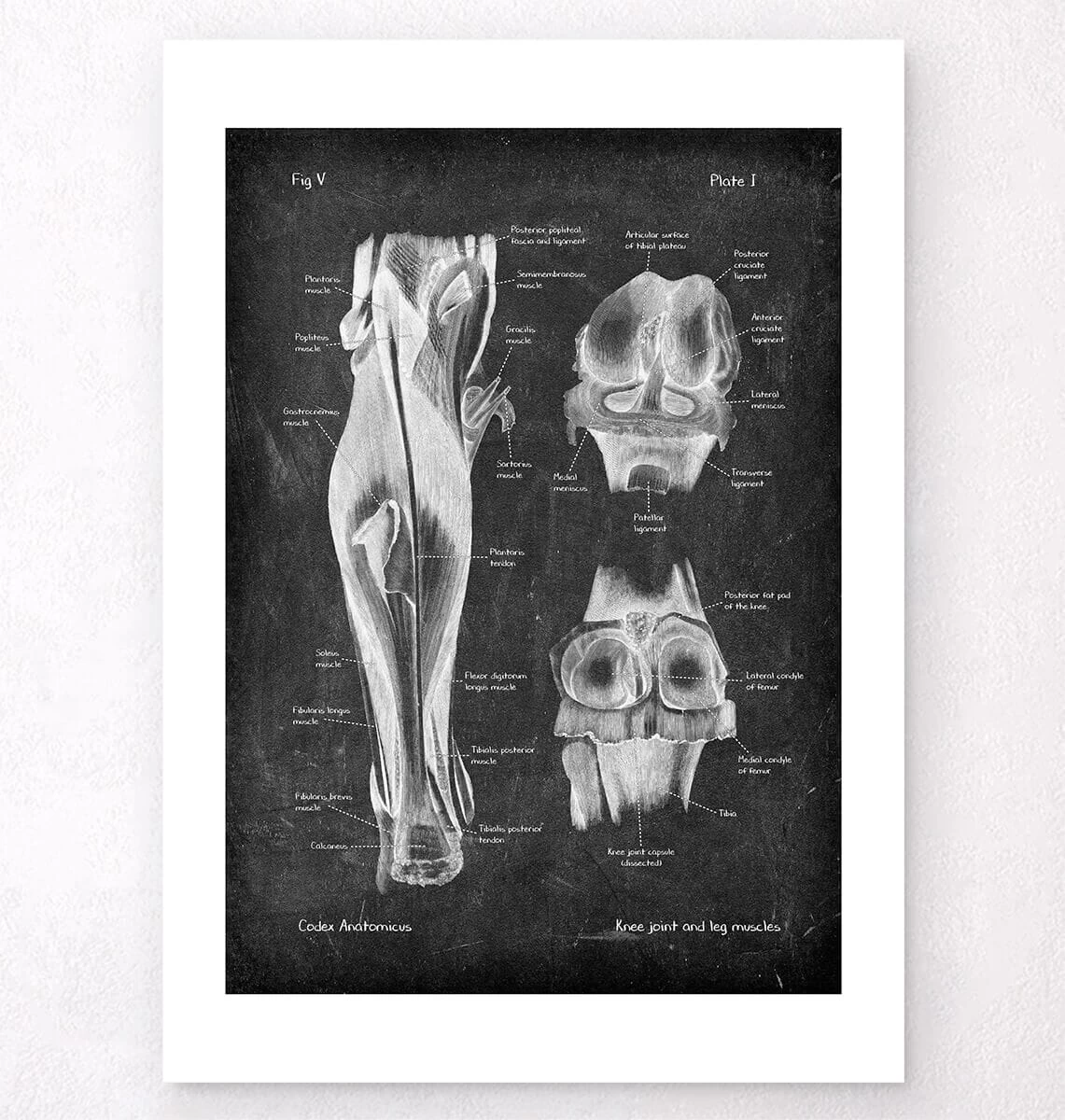 Knee Joint And Leg Muscles - Chalkboard 6 Knee Joint And Leg Muscles - Chalkboard - Image 4