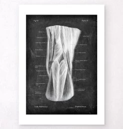 Popliteal Fossa - Chalkboard 7 Popliteal Fossa - Chalkboard -Codex Anatomicus Shop LPA 254 2