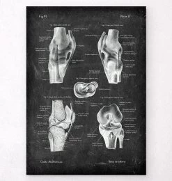 Knee Anatomy Chart - Chalkboard