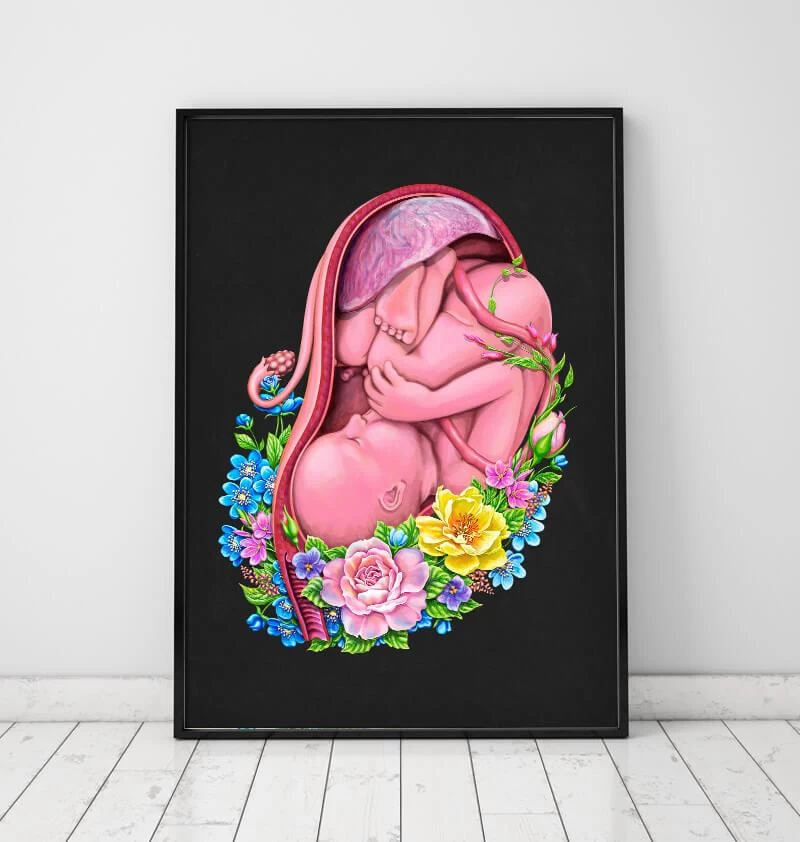 Fetus In A Womb - Floral - Black 4 Fetus In A Womb - Floral - Black - Image 2