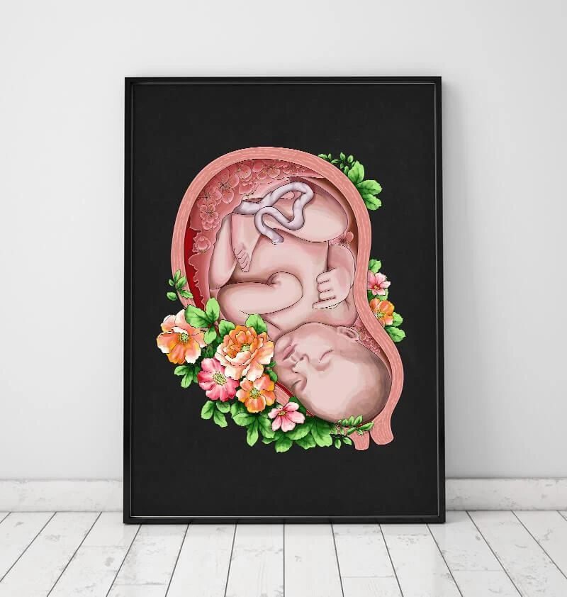 Fetus In A Womb II - Floral - Black 4 Fetus In A Womb II - Floral - Black - Image 2
