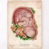 Fetus In A Womb II - Floral - Vintage -Codex Anatomicus Shop LPA695