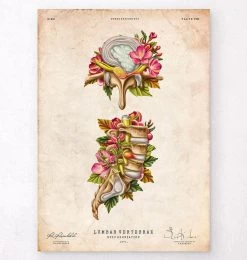 Herniated Disc - Floral - Vintage