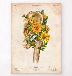 Hip Replacement - Floral - Vintage