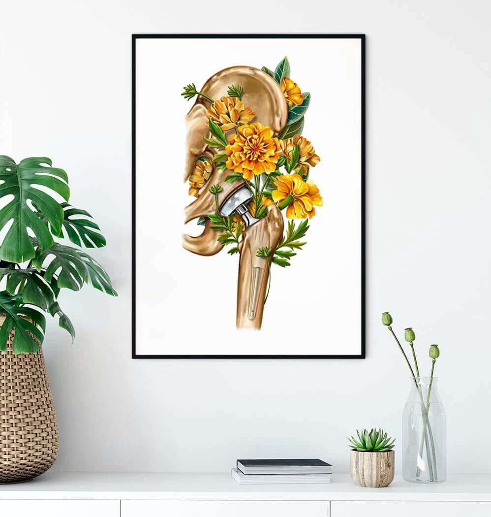 Hip Replacement - Floral - White 4 Hip Replacement - Floral - White - Image 2