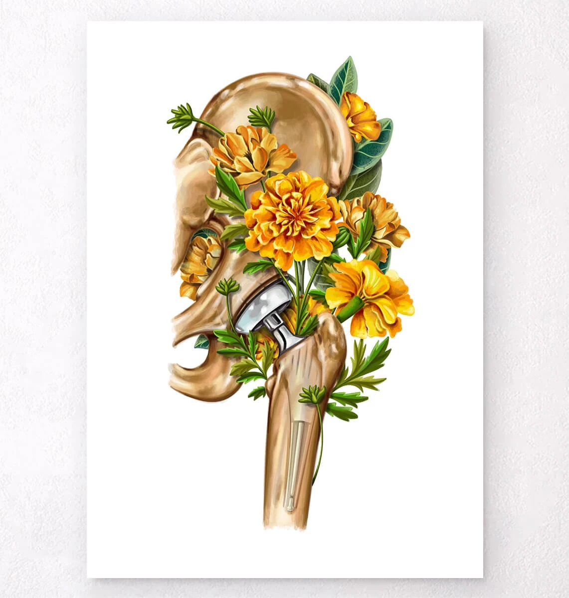 Hip Replacement - Floral - White 3 Hip Replacement - Floral - White