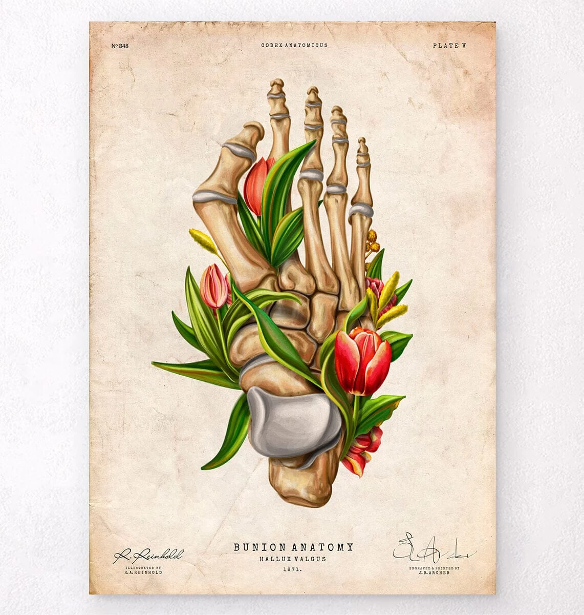 Bunion Anatomy - Floral - Vintage 3 Bunion Anatomy - Floral - Vintage