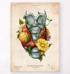 Thyroid Adenoma - Floral - Vintage