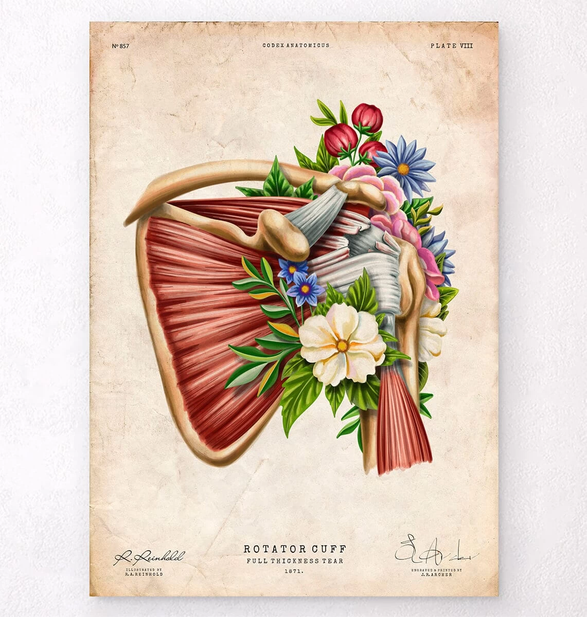 Rotator Cuff Tear - Floral - Vintage 3 Rotator Cuff Tear - Floral - Vintage