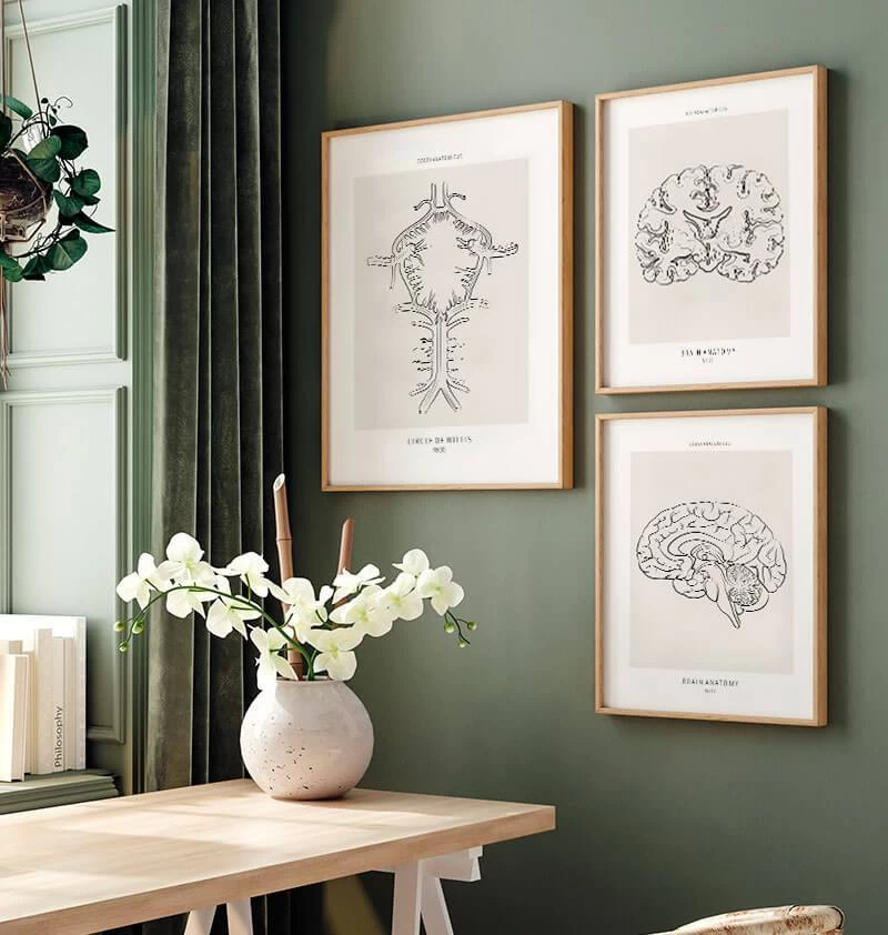 Circle Of Willis - Line Art 5 Circle Of Willis - Line Art - Image 3