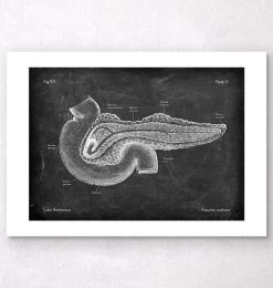 Pancreas Anatomy - Chalkboard -Codex Anatomicus Shop V LPA 210
