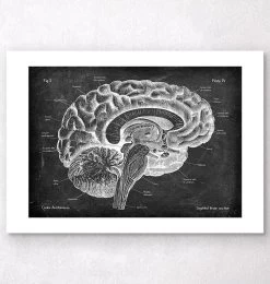 Sagittal Brain Anatomy - Chalkboard -Codex Anatomicus Shop V LPA 212