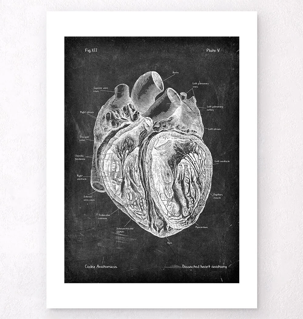 Dissected Heart Anatomy - Chalkboard 6 Dissected Heart Anatomy - Chalkboard - Image 4