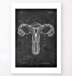 Uterus Anatomy - Chalkboard -Codex Anatomicus Shop V LPA 225