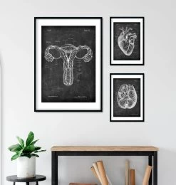 Uterus Anatomy - Chalkboard -Codex Anatomicus Shop V LPA 225 3