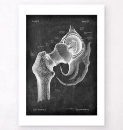 Hip Joint Anatomy - Chalkboard 9 Hip Joint Anatomy - Chalkboard -Codex Anatomicus Shop V LPA 251
