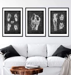 Knee Anatomy Set Of 3 - Chalkboard