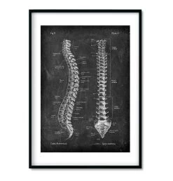 Spine & Back Set Of 3 - Chalkboard 9 Spine & Back Set Of 3 - Chalkboard -Codex Anatomicus Shop spine set 2