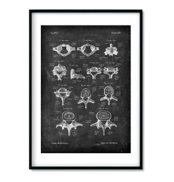Spine & Back Set Of 3 - Chalkboard 10 Spine & Back Set Of 3 - Chalkboard -Codex Anatomicus Shop spine set 3
